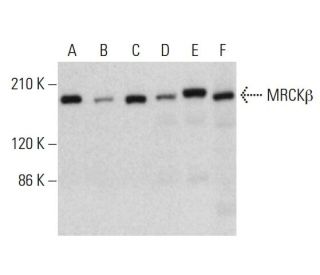 MRCKβ Antibody (D-7) - Western Blotting - Image 382809