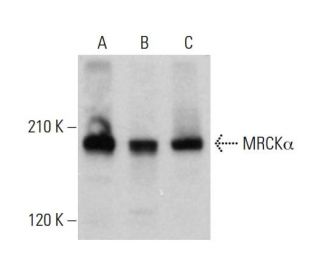 MRCK&alpha; Antibody (B-3) - Western Blotting - Image 382763 