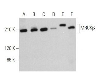 MRCK&beta; Antibody (A-2) - Western Blotting - Image 382810 
