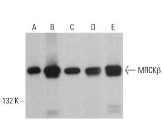 MRCK&beta; Antibody (C-12) - Western Blotting - Image 382336 