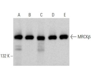 MRCK&beta; Antibody (D-7) - Western Blotting - Image 374178 