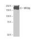 MRCKβ Antibody (Y-2D13) - Western Blotting - Image 65006 