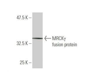MRCK&gamma; Antibody (2C3) - Western Blotting - Image 350227