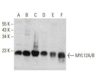 western blotting image from recommended MYL12A/B (A-10) monoclonal antibody replacement. Image 356595