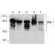 western blotting image from recommended MRE11 (18) monoclonal antibody replacement. Image 385767