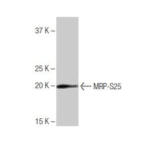 MRP-S25 Antibody (LB-L4) - Western Blotting - Image 65007SAM Transcription Activation: SAM system utilizing dCas9-VP64, MS2-P65-HSF1, and sgRNA for precise gene transcription activation.