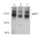 western blotting image from recommended MRP1 (QCRL-1) monoclonal antibody replacement. Image 379308