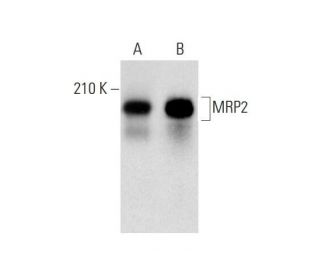 MRP2 Antibody (6D564) - Western Blotting - Image 143529