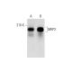 MRP2 Antibody (6D564) - Western Blotting - Image 143529