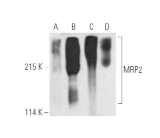 western blotting image from recommended MRP2 (G-1) monoclonal antibody replacement. Image 389911