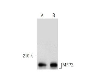 MRP2 Antibody (M2I-4) - Western Blotting - Image 143528