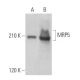 This polyclonal antibody has been discontinued. See our recommended <a href="mrp5-antibody-e-10">MRP5 (E-10)</a> monoclonal antibody (sample data shown). western blotting image from recommended MRP5 (E-10) monoclonal antibody replacement. Image 359025