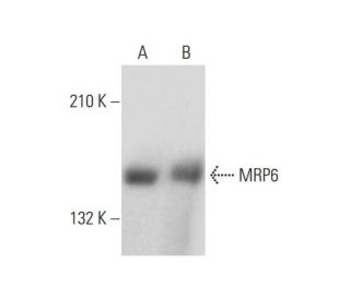MRP6 Antibody (M6II-21) - Western Blotting - Image 147488Each CRISPR/Cas9 Knockout (KO) Plasmid product consists of a pool of 3 plasmids designed to ensure identification and cleavage of a specific gene for maximum knockout efficiency. Each plasmid encodes a unique 20 nt sequence derived from the GeCKO (v2) library.