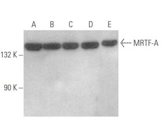 western blotting image from recommended MRTF-A/MKL1 (G-7) monoclonal antibody replacement. Image 354055