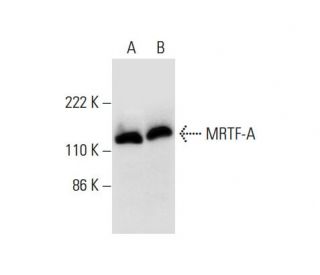 MRTF-A/MKL1 Antibody (G-7) | SCBT - Santa Cruz Biotechnology