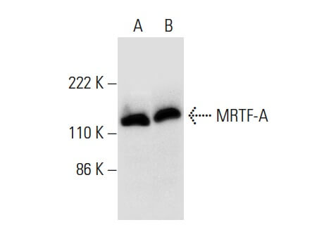 MRTF-A/MKL1 Antibody (G-7) | SCBT - Santa Cruz Biotechnology