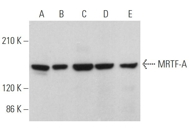 mrtf様 MRTF-A/MKL1 Antibody (G-7) | SCBT - Santa Cruz Biotechnology