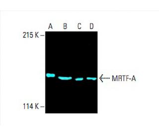 MRTF-A/MKL1 Antibody (G-7) | SCBT - Santa Cruz Biotechnology