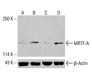 MRTF-A/MKL1 Antibody (G-7) | SCBT - Santa Cruz Biotechnology