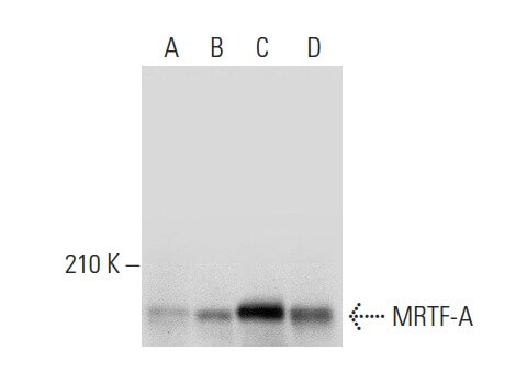 MRTF-A/MKL1 Antibody (G-8) | SCBT - Santa Cruz Biotechnology
