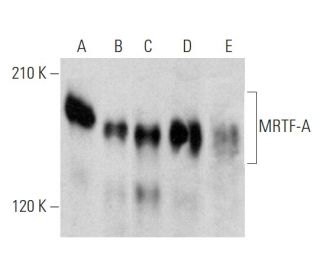 MRTF-A/MKL1 Antibody (G-8) | SCBT - Santa Cruz Biotechnology