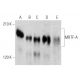 MRTF-A/MKL1 Antibody (G-8) - Western Blotting - Image 353665 