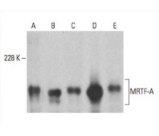MRTF-A/MKL1 Antibody (G-8) - Western Blotting - Image 393573 