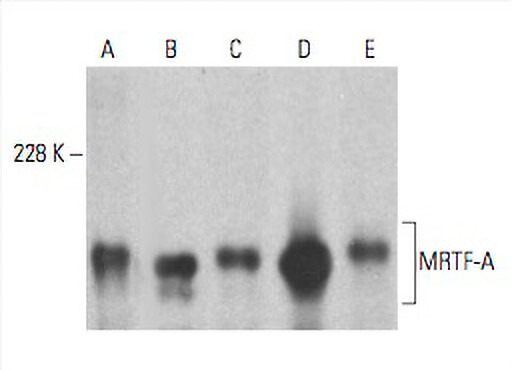mrtf様 Identification of novel inhibitors of the transcriptional