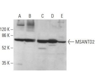 MSANTD2 Antibody (B-8) - Western Blotting - Image 379583 