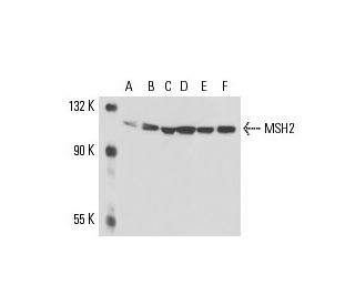 MSH2 Antibody (25D12) - Western Blotting - Image 16175 