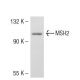 MSH2 Antibody (25D12) - Western Blotting - Image 53479