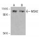 MSH2 Antibody (D-9) - Western Blotting - Image 415983