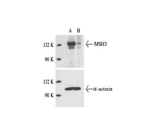 MSH3 siRNA (h): sc-35971. Western blot analysis of MSH3 expression in non-transfected control (A) and MSH3 siRNA transfect 