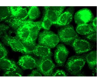 Direct Smear Atlas: A Monograph of Gram-Stained Preparations