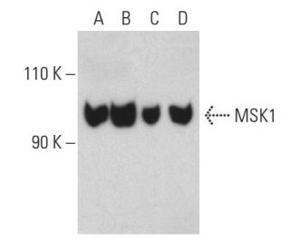 MSK1 Antibody (F-4) - Western Blotting - Image 399468SAM Transcription Activation: SAM system utilizing dCas9-VP64, MS2-P65-HSF1, and sgRNA for precise gene transcription activation.