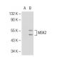 MSK2 Antibody (2934C1a) - Western Blotting - Image 109624