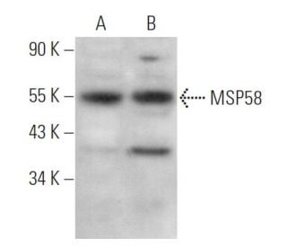 MSP58 Antibody (B-5) - Western Blotting - Image 369889 