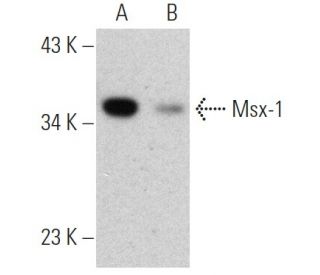 Msx-1 Antibody (5D11) - Western Blotting - Image 368591Each CRISPR/Cas9 Knockout (KO) Plasmid product consists of a pool of 3 plasmids designed to ensure identification and cleavage of a specific gene for maximum knockout efficiency. Each plasmid encodes a unique 20 nt sequence derived from the GeCKO (v2) library. 