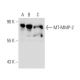 MT-MMP-2 Antibody (YZ-12) - Western Blotting - Image 50305