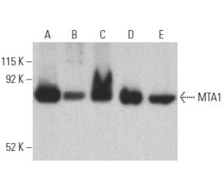 MTA1 Antibody (E-12) - Western Blotting - Image 400027
