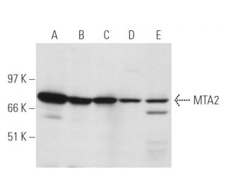 western blotting image from recommended MTA2 (F-9) monoclonal antibody replacement. Image 14773