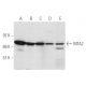 western blotting image from recommended MTA2 (F-9) monoclonal antibody replacement. Image 14773
