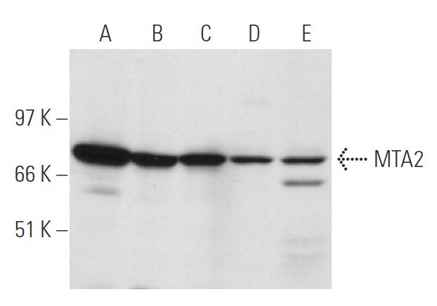 mta2-antibody-f-9-western-