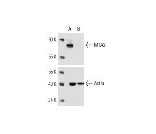 MTA2 siRNA (h): sc-35983. Western blot analysis of MTA2 expression in non-transfected control (A) and MTA2 siRNA transfect 