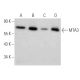 western blotting image from recommended MTA3 (428C2a) monoclonal antibody replacement. Image 368187