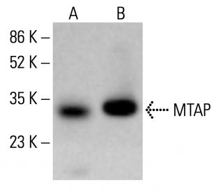 MTAP Antibody (42-T) | SCBT - Santa Cruz Biotechnology MTAP Antibody (42-T) | SCBT - Santa Cruz Biotechnology