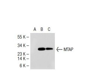 MTAP Antibody (42-T) - Western Blotting - Image 37345SAM Transcription Activation: SAM system utilizing dCas9-VP64, MS2-P65-HSF1, and sgRNA for precise gene transcription activation.