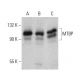 Dieser polyklonale Antikörper wird nicht mehr hergestellt. Wir empfehlen Ihnen unseren <a href="mtbp-antibody-b-5">MTBP (B-5)</a> monoklonalen Antikörper (Beispielsdaten werden angezeigt). western blotting image from recommended MTBP (B-5) monoclonal antibody replacement. Image 385176
