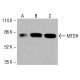 MTDH Antibody (2F11C3D4) - Western Blotting - Image 416137