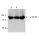 MTHFD1L Antibody (D-7) - Western Blotting - Image 358679 